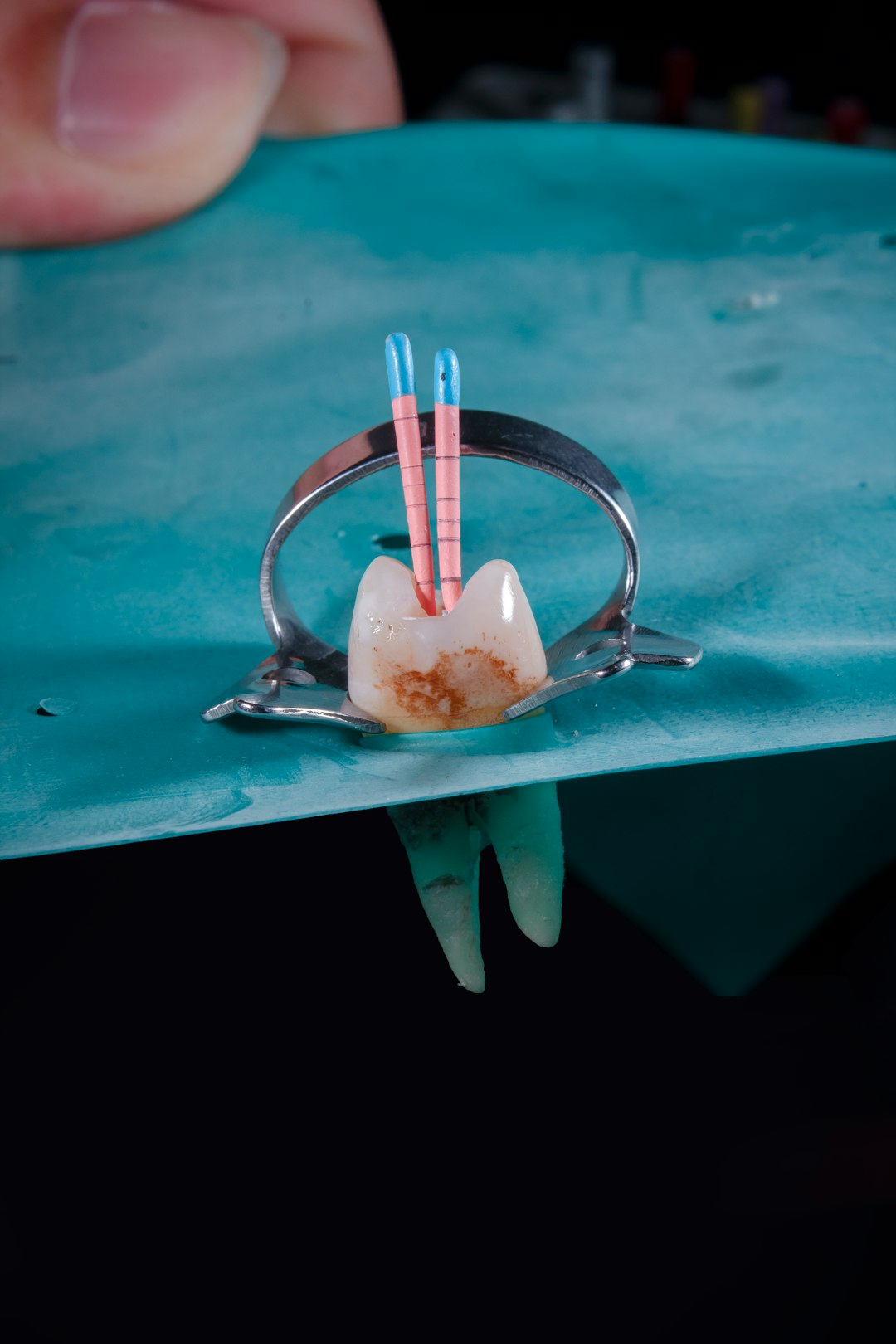 Modern Technology in Dental Care at Las Vegas Dental Group